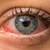 Изкуствените мигли водят до кръвоизливи в очите