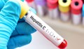 Отпада болезнено изследване при назначаване на лечение за хепатит С