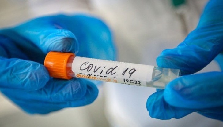 Поредната положителна проба за коронавирус е при 32-годишен мъж