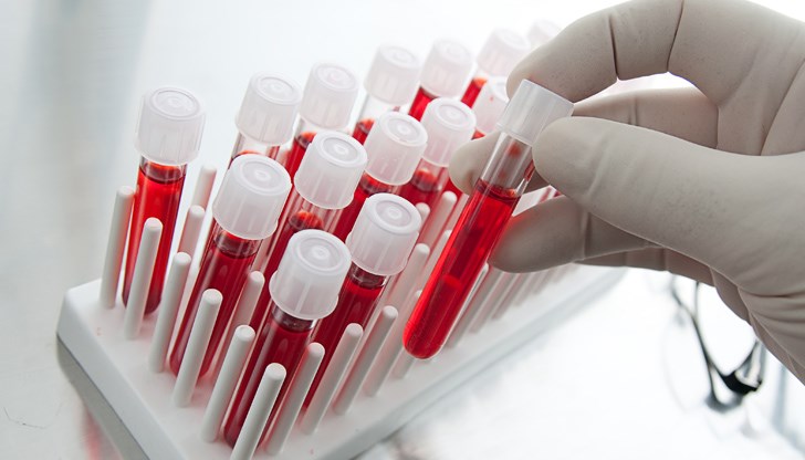 Пилотно серумът ще бъде изработен с помощта на 10 пациенти-доброволци