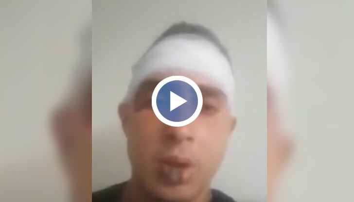 Мъжът е със счупена челюст, шевове и травми по главата