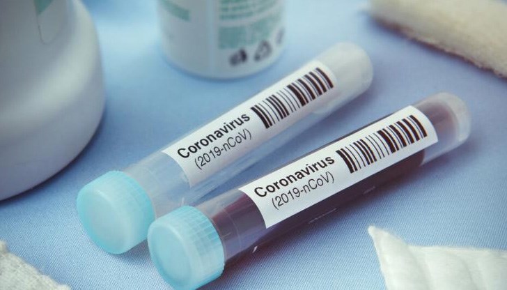 Едната проба е на човек, завърнал се от чужбина Едната проба е на човек, завърнал се от чужбина