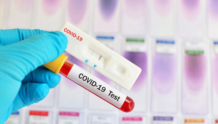 150 различни видове тестове има за установяване на коронавирус или антитела