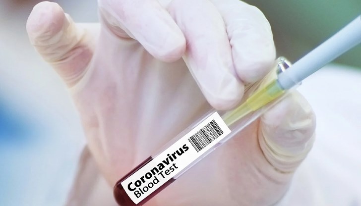 Според италианските учени коронавирусът може да бъде контролиран