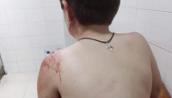 Петима мъже се опитват да разтърват момчето от захапката на 50-килограмото животно