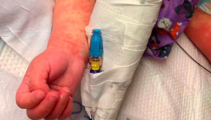 То има общи симптоми с токсичен шок и болестта на Кавазаки - треска, обриви, подути жлези и в тежки случаи - възпаление на сърцето