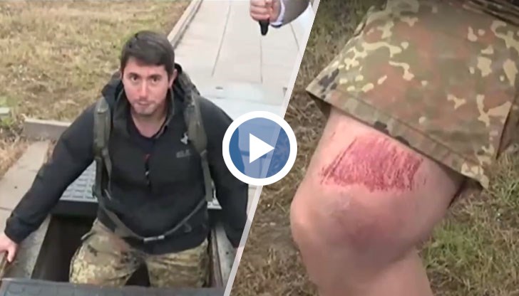 Мъжът е наранил крака си