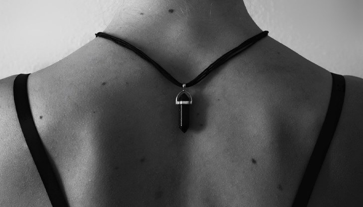 Очевидни признаци на дегенерация на червената бенка са всякакви външни промени като сърбеж, лющене, увеличаване на размера, промяна в цвета Очевидни признаци на дегенерация на червената бенка са всякакви външни промени като сърбеж, лющене, увеличаване на размера, промяна в цвета