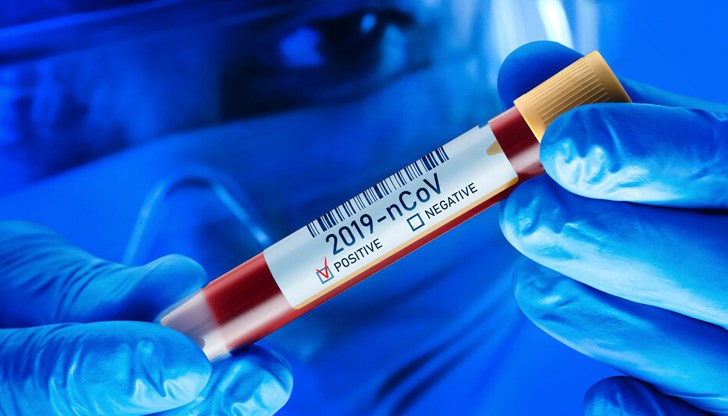 Те са били контактни на 45-годишния служител на РЗОК с установена положителна проба на 24 юни