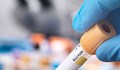 В България няма регистър на заразените с най-коварния хепатит С