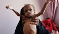 Глад е надвиснал над 10 милиона души в Йемен