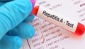 Как ще се източва здравната каса: Диагностика на хепатит се увеличава от 10 на 1700 лв.