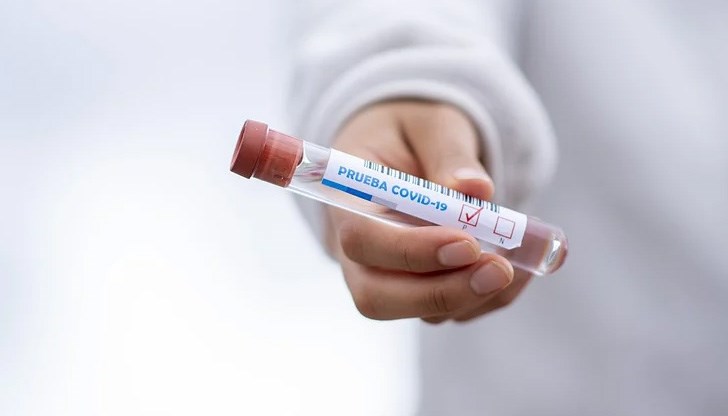 През последното денонощие са направени общо 2 806 PCR-теста През последното денонощие са направени общо 2 806 PCR-теста