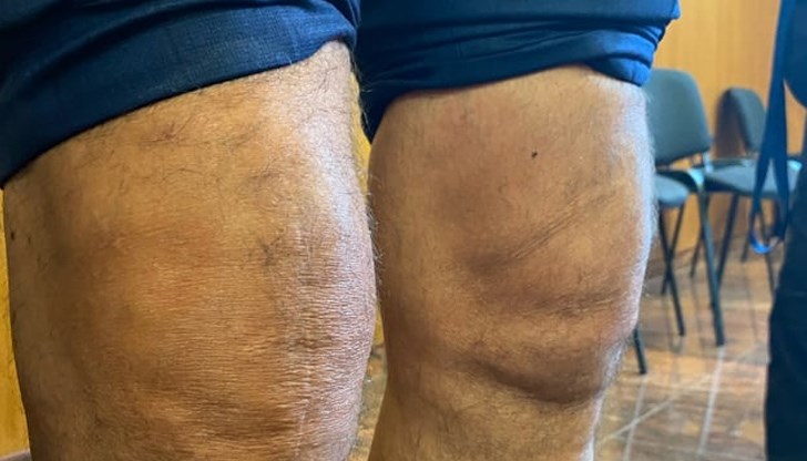 Очевиден е проблемът с коляното на Бобоков