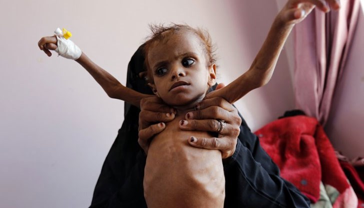 Два милиона деца, плюс милион бременни или кърмещи жени, се нуждаят от лечение поради остро недохранване в Йемен