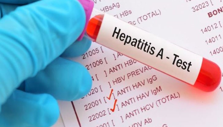 Експертите са против връщането на старите критерии, защото ограничават достъпа на пациентите до лечение на фона на драстично намаляване на лекуваните