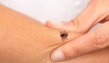 Два случая на Лаймска болест за изминалата седмица във Варна