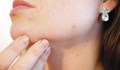 Бум на кожните проблеми заради продължителното носене на маски