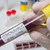 Европа прехвърли прага от 150 000 нови случая на коронавирус на ден