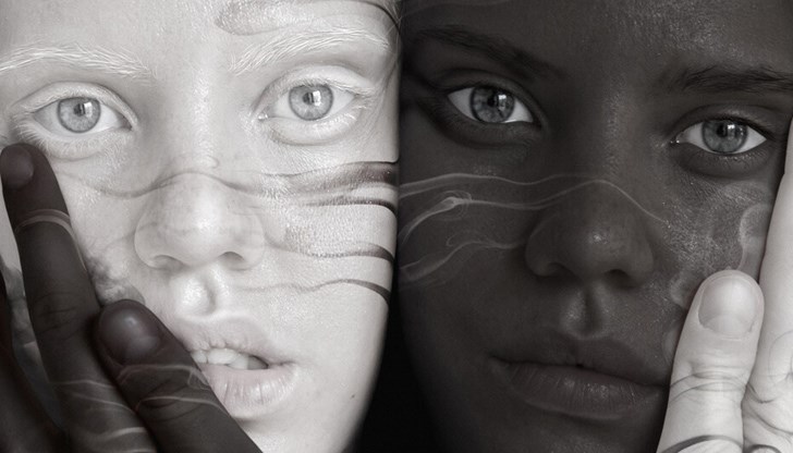 Причината за тези случаи се крие в т. нар. окулокутанен албинизъм тип 2. Това е наследствено състояние, при което хората не произвеждат достатъчно меланин и това се отразява на външния им вид, главно на очите, кожата и косата Причината за тези случаи се крие в т. нар. окулокутанен албинизъм тип 2. Това е наследствено състояние, при което хората не произвеждат достатъчно меланин и това се отразява на външния им вид, главно на очите, кожата и косата