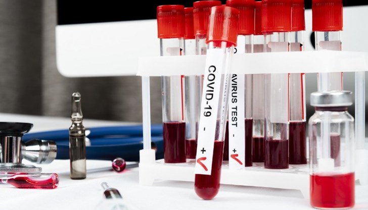 Медицински надзор почва проверки по частните и държавните лабораториите, които правят тестове за коронавирус