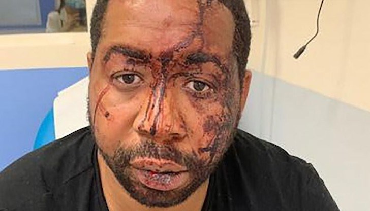 Както се твърди, кадрите, заснети от охранителна камера, показват как няколко служители на реда нападат музикален продуцент в студиото му Както се твърди, кадрите, заснети от охранителна камера, показват как няколко служители на реда нападат музикален продуцент в студиото му