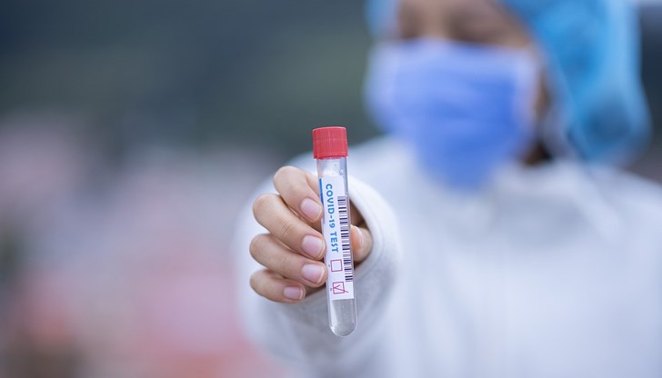 Лек спад на случаите на коронавирус у нас