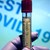 Правителството отпусна още 125 милиона лева за ваксини срещу COVID–19