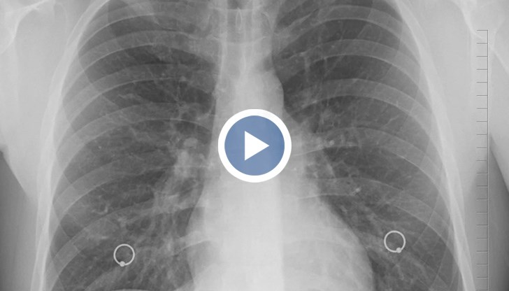 Признаването на антигенните тестове ще помогне за по-точна статистика на носителите на заразата, като така и повече хора с коронавирус ще подлежат на карантина