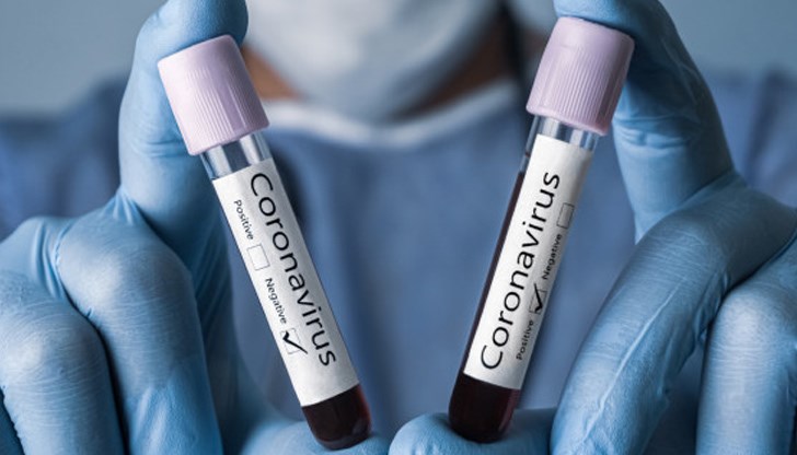 Системата като цяло не дава признаци за нормализация - продължаваме да губим всеки ден млади хора без данни за съпътстващи заболявания, а едно предписание за 10-дневна карантина стига до получателя си на 19-ия ден Системата като цяло не дава признаци за нормализация - продължаваме да губим всеки ден млади хора без данни за съпътстващи заболявания, а едно предписание за 10-дневна карантина стига до получателя си на 19-ия ден