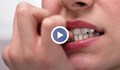 5 неподозирани последици от гризането на ноктите