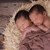 Заради инвитро технологията - бум на ражданията на близнаци в световен мащаб