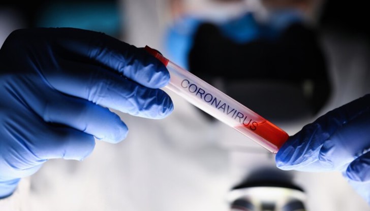 24,4 на сто от пробите са положителни 24,4 на сто от пробите са положителни