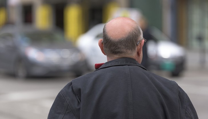 Учени откриха вещество, което не само предотвратява плешивостта, но и насърчава растежа на косата