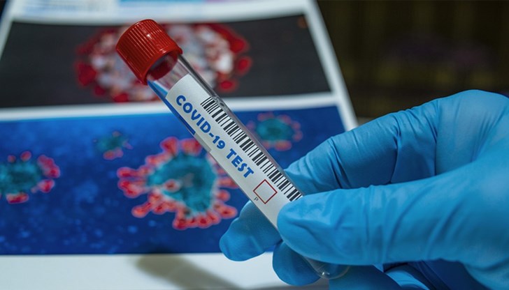3988 са новодиагностицираните с коронавирусна инфекция в страната през изминалите 24 часа