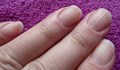 Какво означава, ако имате ивици по ноктите?