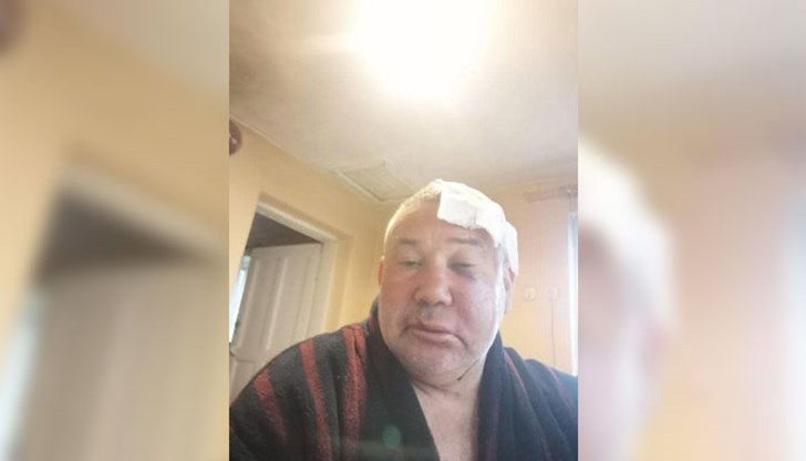 Председателят на Общинския съвет в Каварна, също от ГЕРБ, отрича да е замесен в побоя