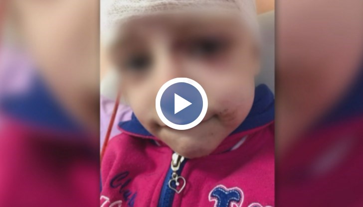 Детето е претърпяло належаща операция