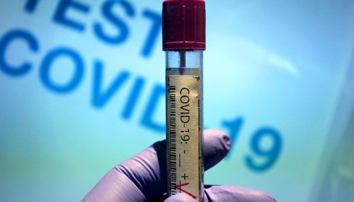 За последното денонощие са починали две жени и трима мъже с положителен тест за коронавирус