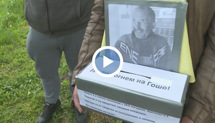 Георги е с почти 40% изгаряния, настанен е в „Пирогов“, а днес му предстои тежка операция