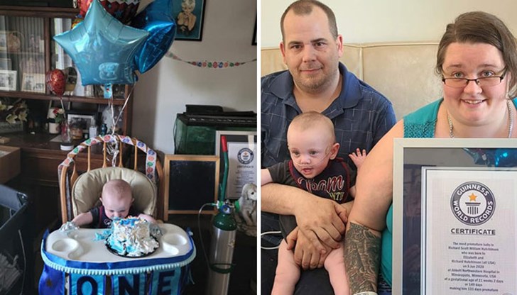 Малкият Ричард е тежал едва 340 грама при раждането си