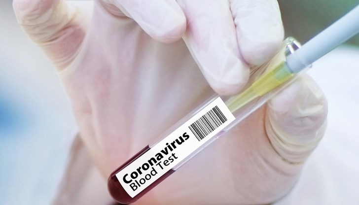 Досега това беше възможно само с PCR или ваксина