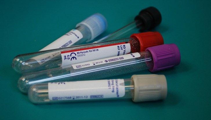 Много от наличните сега тестове за антитела биха могли да ви кажат дали имате антитела в резултат на боледуване от COVID, а не след получаване на ваксина