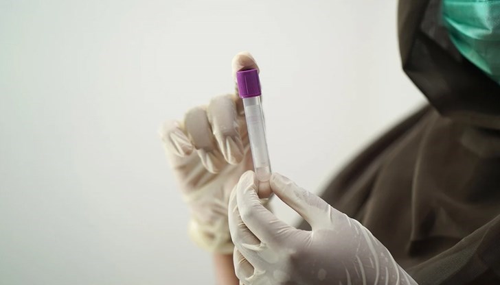 Случаите представляват 0,9 % от направените проби