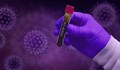 Имунолог от Цюрих предупреди за появата на супервирус – COVID-22