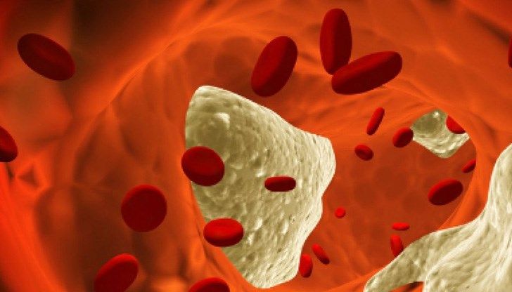 Рискът от венозна тромбоемболия след ваксинация намалява драстично