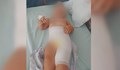 2-годишно дете получи изгаряне в столична детска ясла