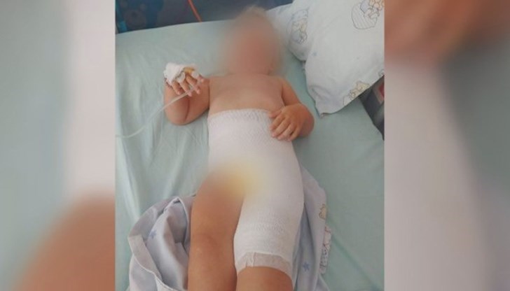 Детето е прието в "Пирогов"  с диагноза химическо изгаряне