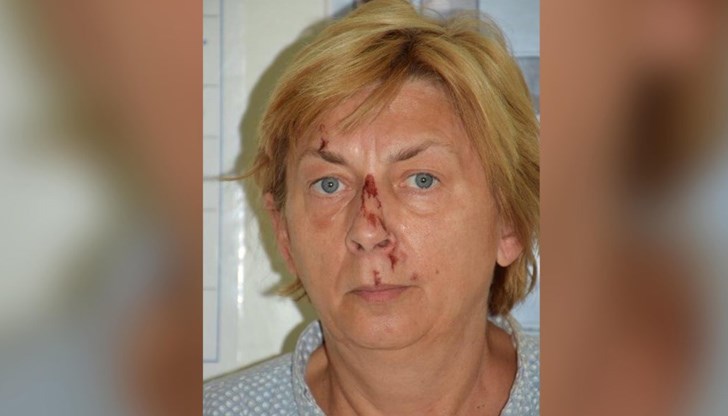 На жената, за която се смята, че е на около 60 години, е оказана медицинска помощ, след като е била намерена на 12 септември на остров Крък в Северна Хърватия