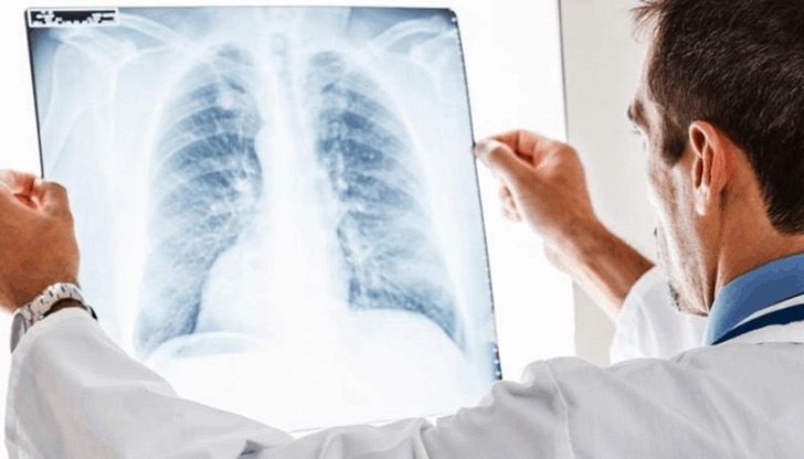 В световния ден на белия дроб обръщаме поглед към тази болест